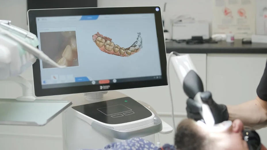 Intraoral scanner capturing a digital 3D impression chairside