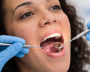 Oral Cancer Screening 2