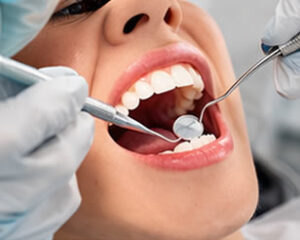 Professional Cleanings